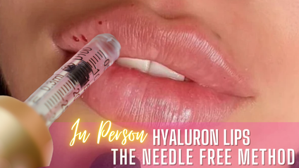 Product image for IN PERSON Hyaluron Lips Training - Certification - Kit Included