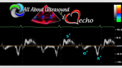Product image for All About Echocardiography - Left Ventricular Diastology NON-CME