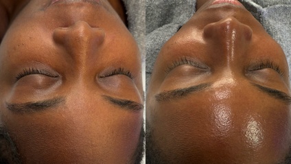 Product image for Dermaplane Advanced technique