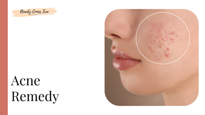 Product image for Acne Remedy