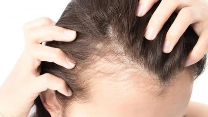 Product image for Mane Mastery: Navigating Menopausal Hair Loss with Science