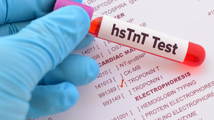 Product image for Measurement of high sensitivity troponin T in patients with early-stage Lyme disease: possible evidence for subclinical cardiac involvement
