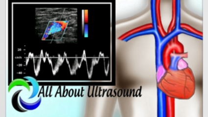 Product image for All About Vascular Ultrasound - Upper Extremity Duplex NON-CME