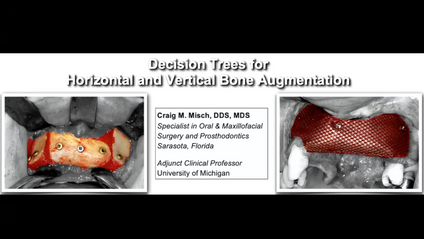 Product image for A Decision Tree for Horizontal and Vertical Bone Augmentation Strategies