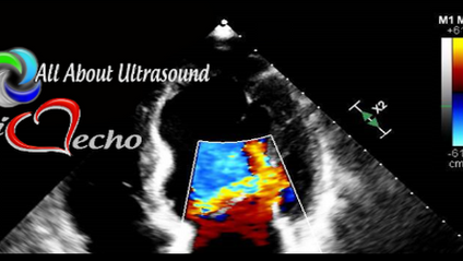 Product image for Adult Echocardiography - Test & Learn Registry Review Quiz