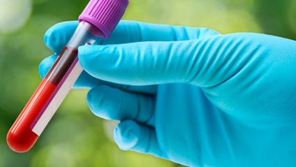 Product image for Seven years of blood-based Lyme disease testing