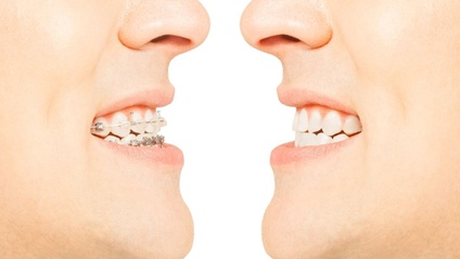Product image for Class III Correction by Dr Derek Mahony