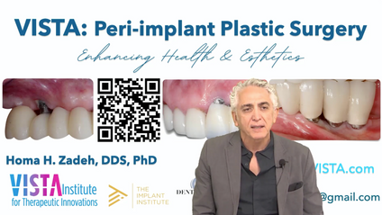Product image for Peri-implant Plastic Surgery with VISTA