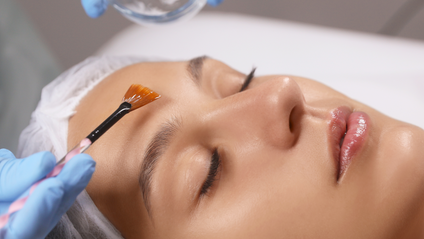 Product image for Superficial Chemical Peel