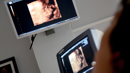 Product image for AI for Diagnostic Medical Sonographers 