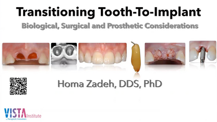Product image for Immediate Implant Placement Into Anterior and Molar Sites