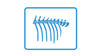 Product image for Basic Thoracic Radiology