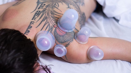 Product image for Therapeutic Cupping Shoulder girdle - Online