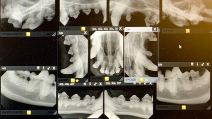 Product image for Dental X-ray Positioning: On-Demand Instruction - Part 1