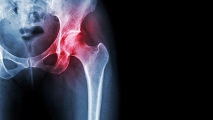 Product image for Foundations of Orthopedics: Basics of Bone and Joint Care