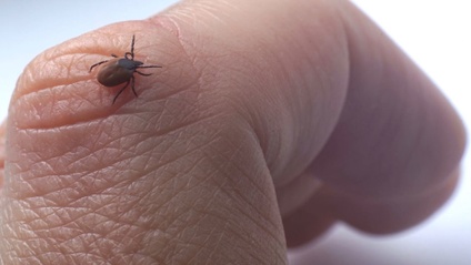Product image for Managing Ixodes scapularis bites