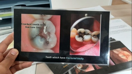 Product image for Before and After Dental Photocard Templates