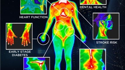 Product image for 1:1 with Victoria Dental-Medical Thermography Consultation