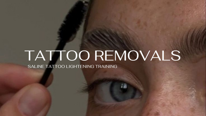 Product image for Tattoo Removals: Saline Method