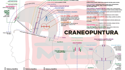Product image for Curso Online Neuro Craneopuntura