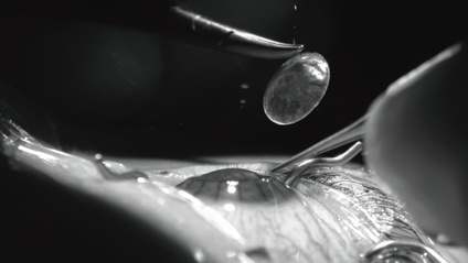 Product image for Corneal Oedema Case Presentations. 