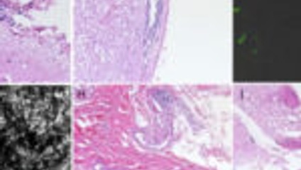 Product image for Antibiotic efficacy for treatment of Lyme disease