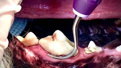 Product image for Periodontal Therapy - On Demand Course (1 hour)