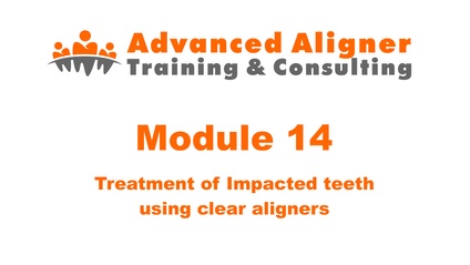 Product image for #14 - Treatment of Impacted teeth using clear aligners