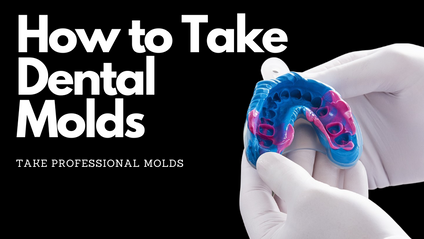 Product image for Mold Impression