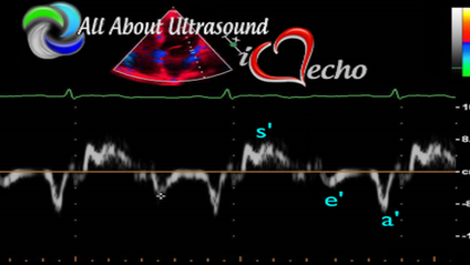 Product image for Advanced Cardiac Sonographer (ACS) - Test & Learn Registry Review Quiz