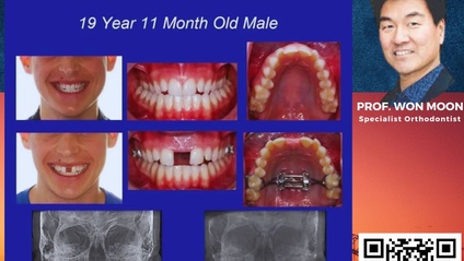 Product image for Christmas offer MSE