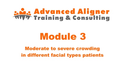 Product image for #3 - Moderate to severe crowding in different facial types patients