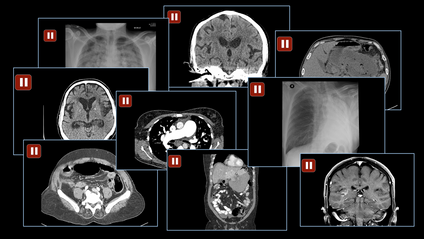 Product image for Demons of the Night: Brain, Chest and Abdomen On-Call Case Collection