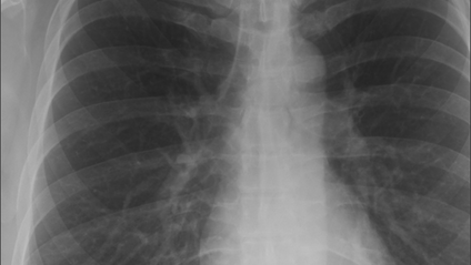 Product image for Diagnostic Imaging Interpretation (X-Rays Unit 1)