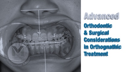 Product image for Advanced Orthodontic and Surgical Considerations in Orthognathic Treatment
