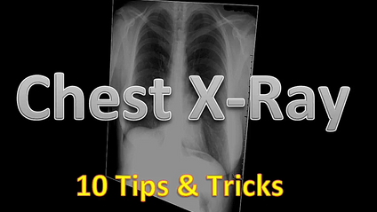 Product image for 10 Chest X-Rays Tips and Tricks