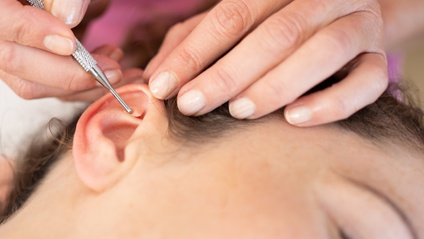 Product image for Ear Seeds and Basic Auricular Reflexology PLUS Advanced Auricular Therapy