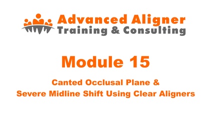 Product image for #15 - Canted Occlusal Plane & Severe Midline Shift Using Clear Aligners