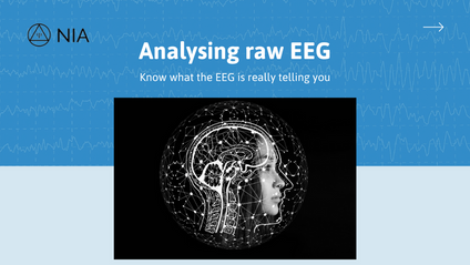Product image for Analysing Raw EEG