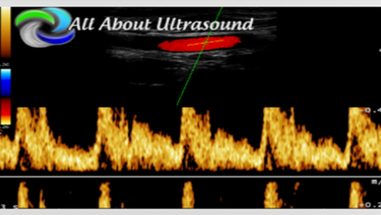 Product image for All About Ultrasound Physics - Doppler Principles & Hemodynamics NON-CME