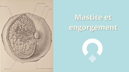 Product image for Mastite et engorgement