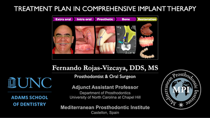 Product image for Treatment Plan in Comprehensive Implant 