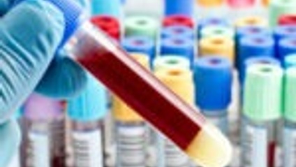 Product image for Serologic testing in Lyme disease