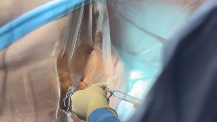 Product image for OB Anesthesia Accelerator Course: On Demand