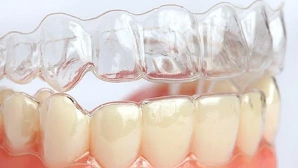Product image for Clear Aligner Maxi-Residency 2025-26
