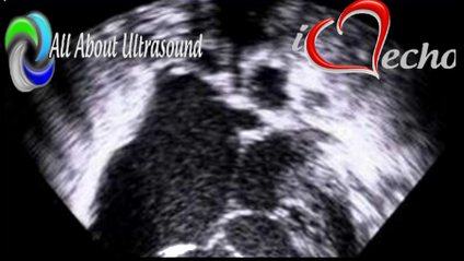 Product image for Pediatric Echocardiography - Test & Learn Registry Review Quiz