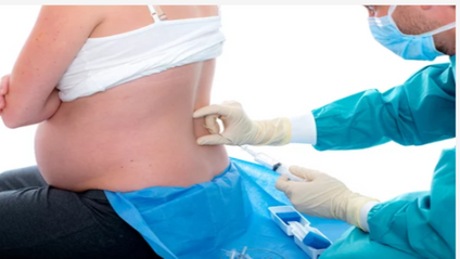 Product image for Epidurals and the Doula's Role