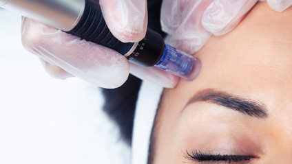 Product image for Level 4 Certificate in Skin Needling Treatments