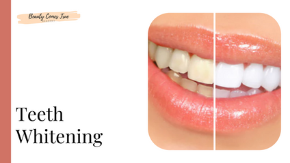 Product image for Teeth Whitening