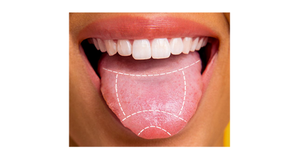 Product image for Advanced Tongue Diagnosis: Innovative Models (2025)